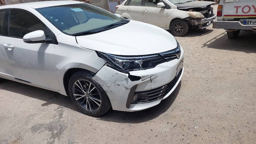 قبل و بعد صافکاری